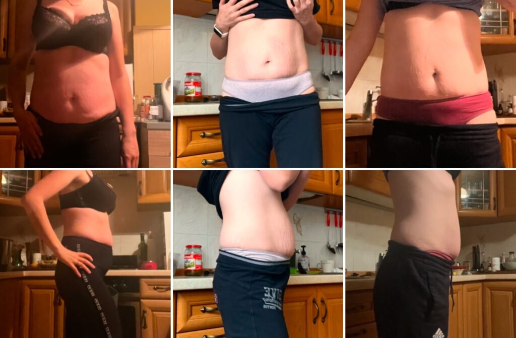 biohacking konsultacje